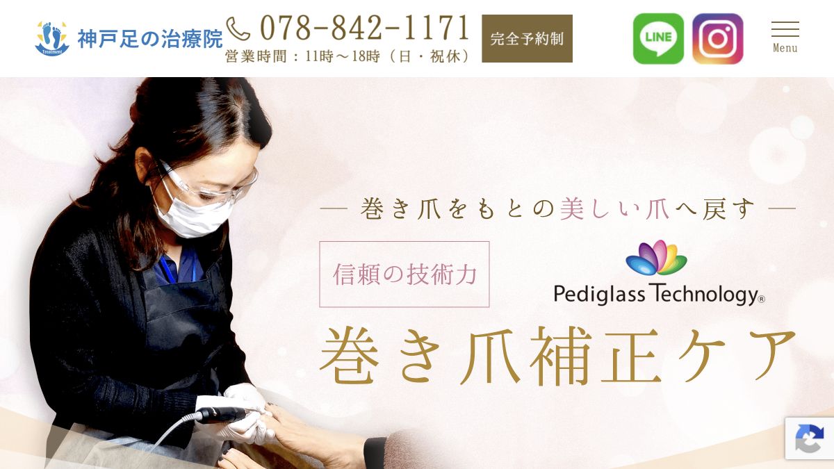 神戸足の治療院公式サイトの巻き爪補正ケア案内