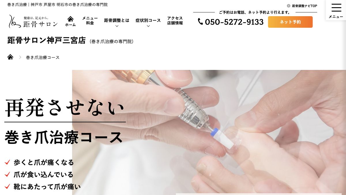 距骨サロン神戸三宮店公式サイトの巻き爪治療コース案内