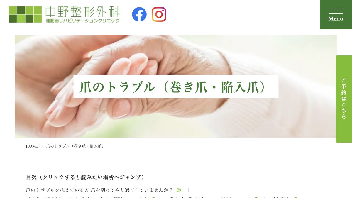 中野整形外科 巻き爪治療公式サイトのサービス案内